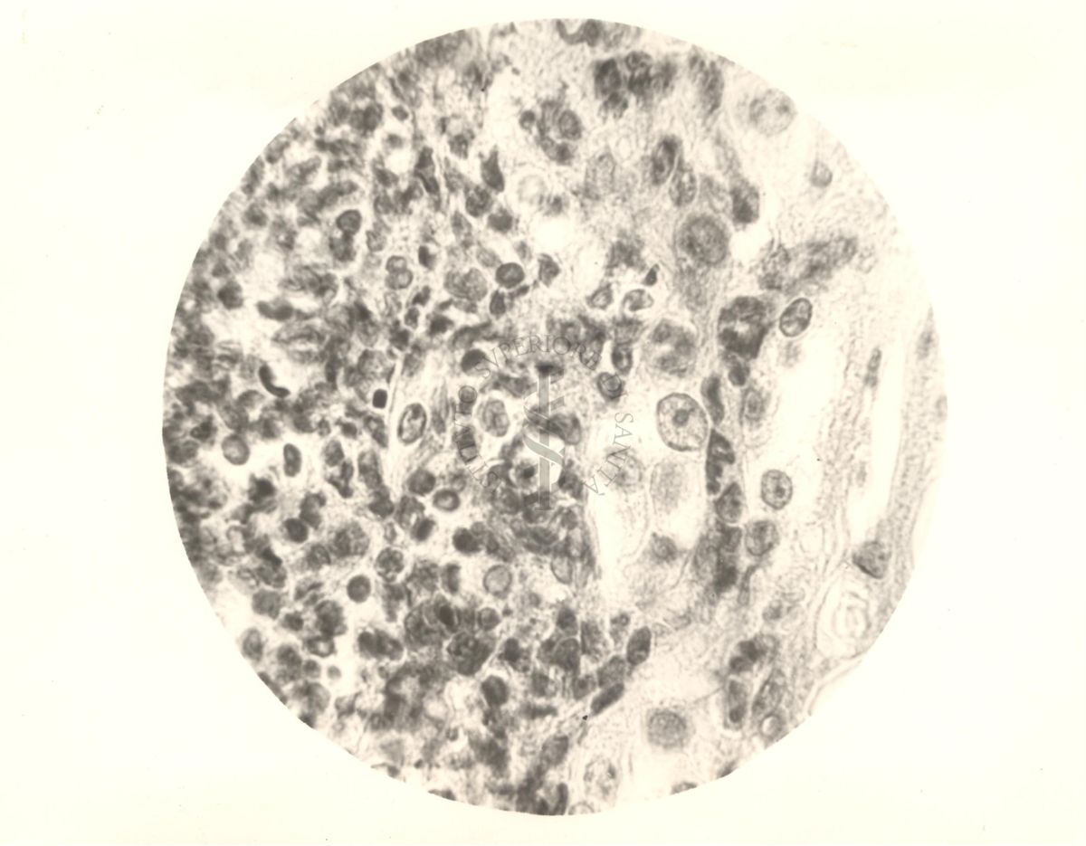 Organo di topo inoculato con tubercolina