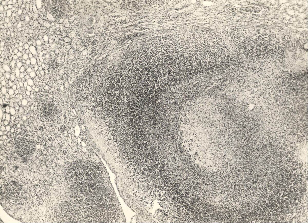 Organo di topo inoculato con tubercolina