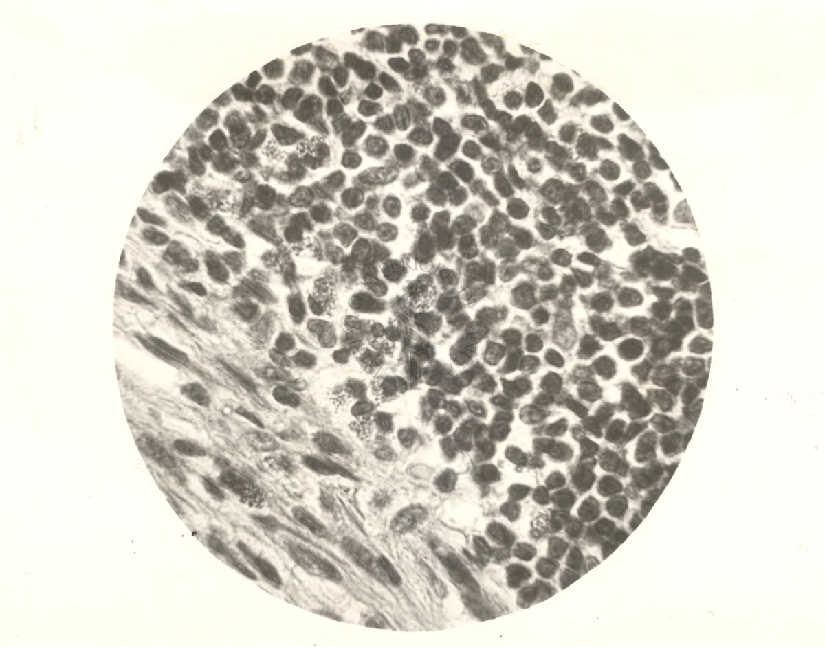 Organo di topo inoculato con tubercolina