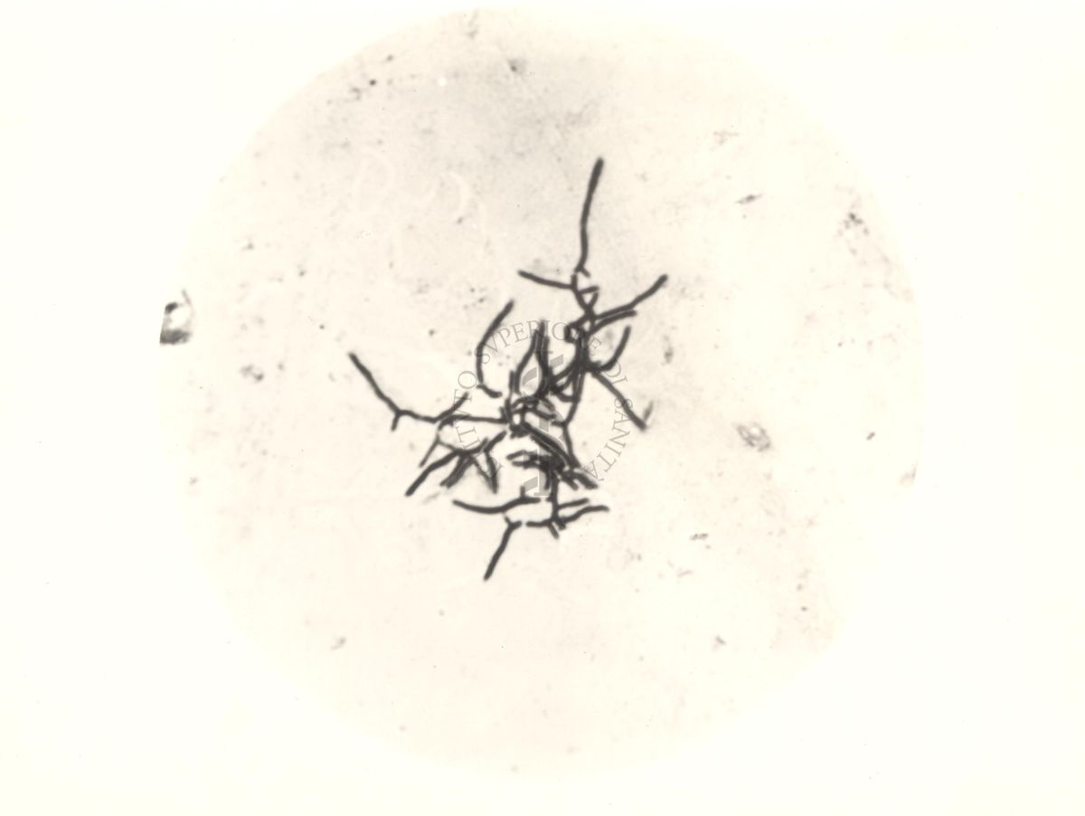 Mycobacterium pellegrini - coltura su vetrino