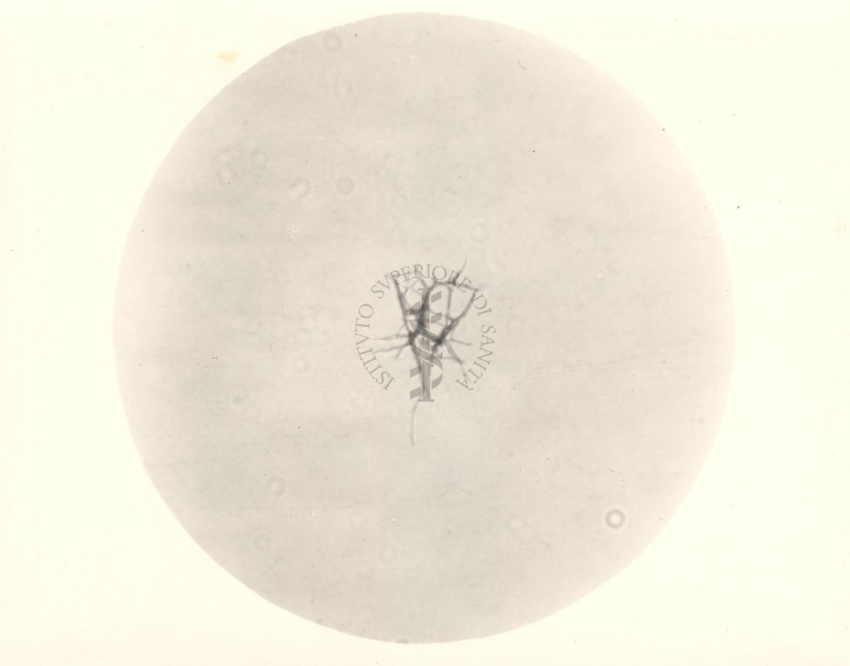 Mycobacterium pellegrini - coltura su vetrino
