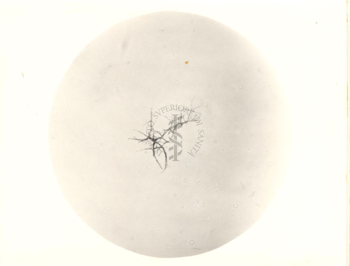 Mycobacterium pellegrini - coltura su vetrino