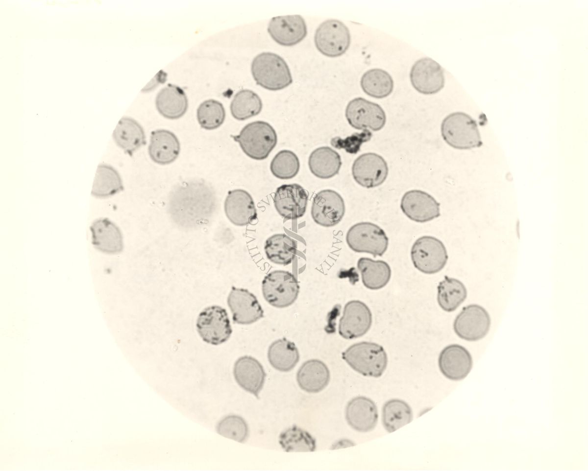 Bartonella muris