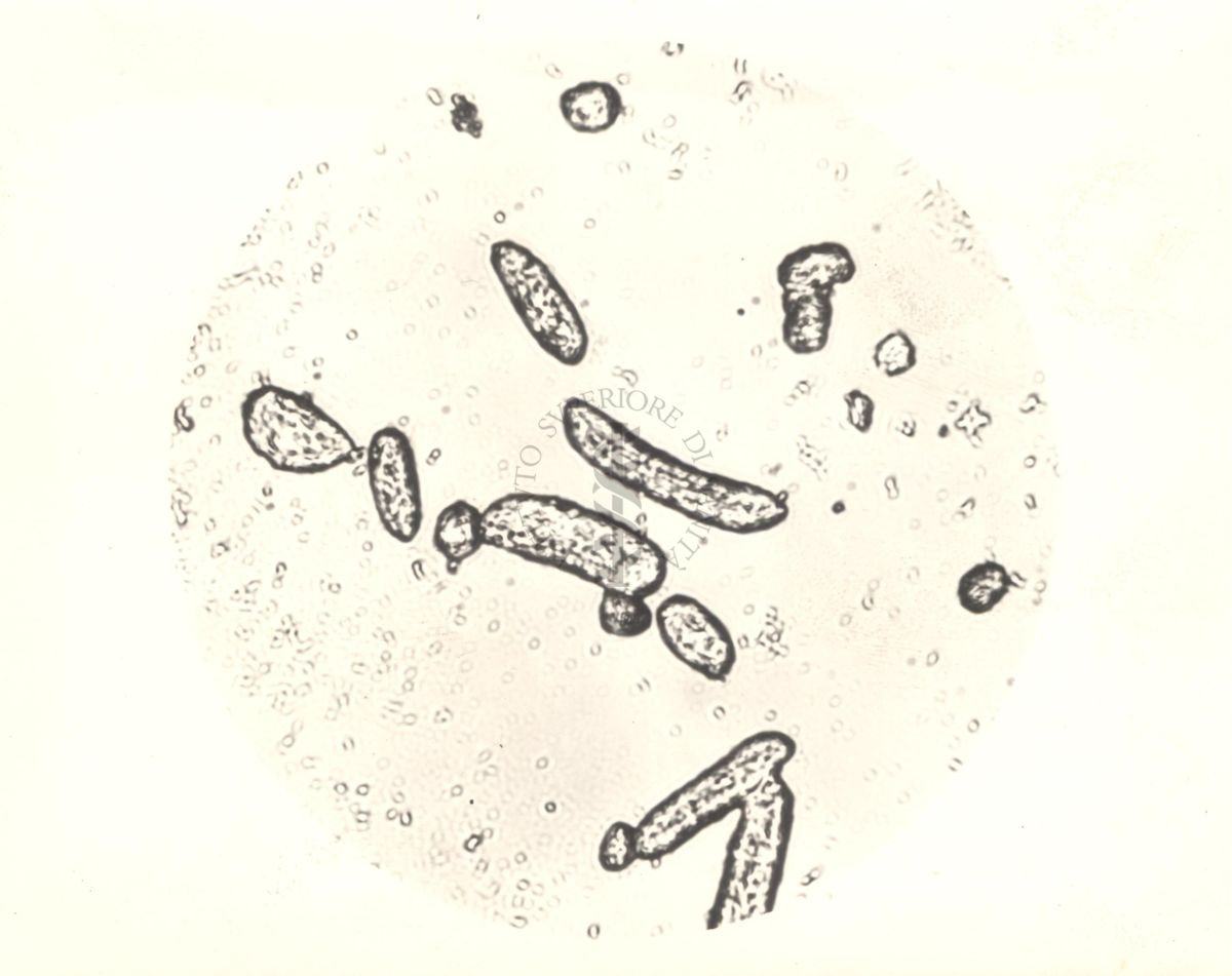 Immagine al microscopio di Colonie di Mycobacterium phlei in terreno liquido