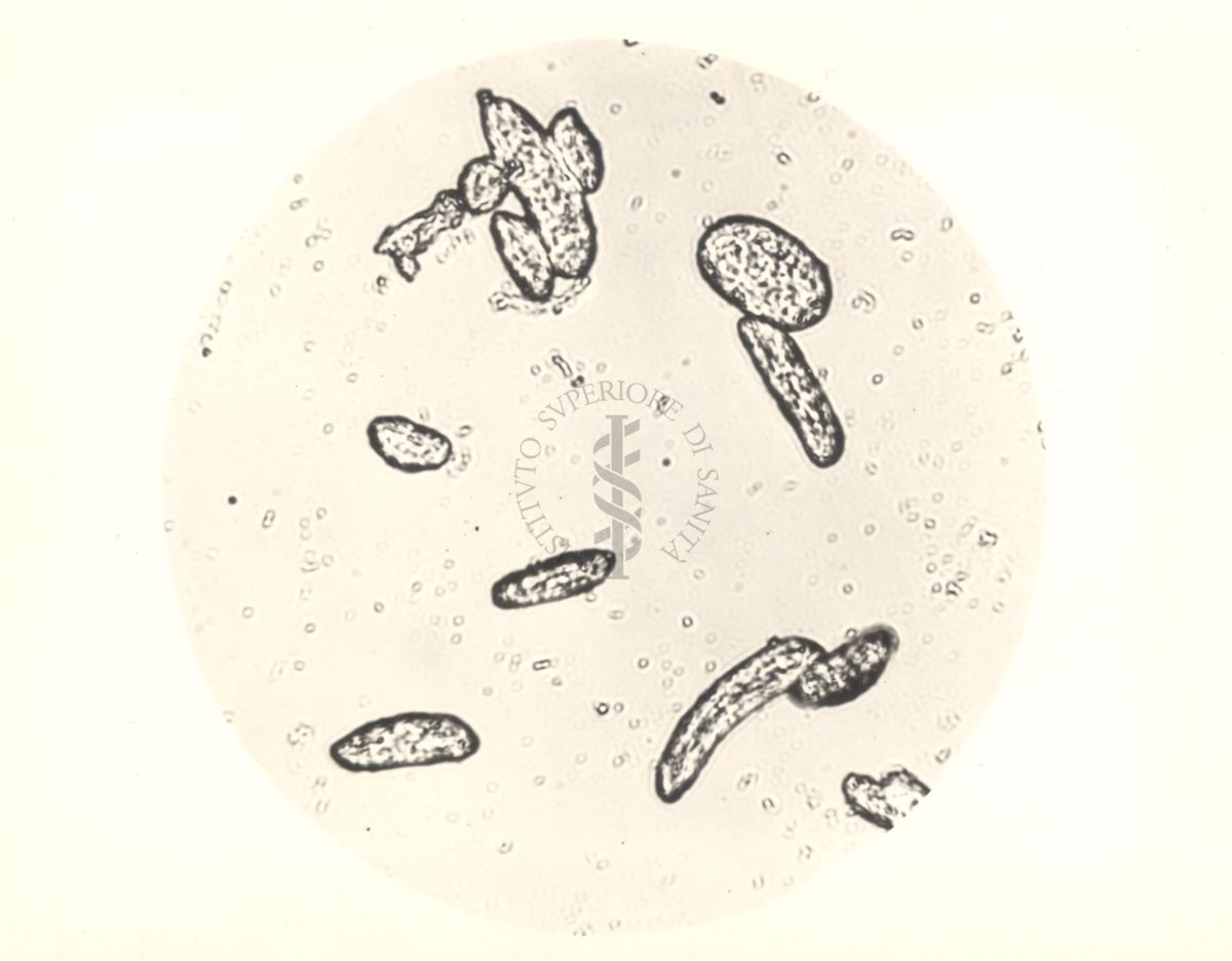 Immagine al microscopio di Colonie di Mycobacterium phlei in terreno liquido