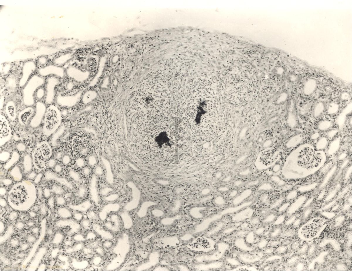 Immagine al microscopio di preparato di cavia inoculata con Cow 70