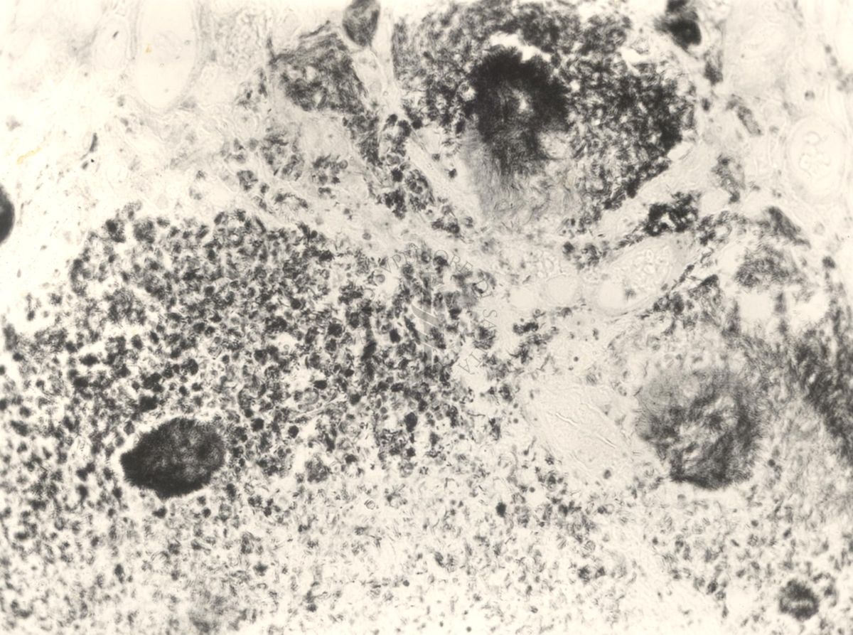 Immagine al microscopio di preparato di topino inoculato con Cow 70