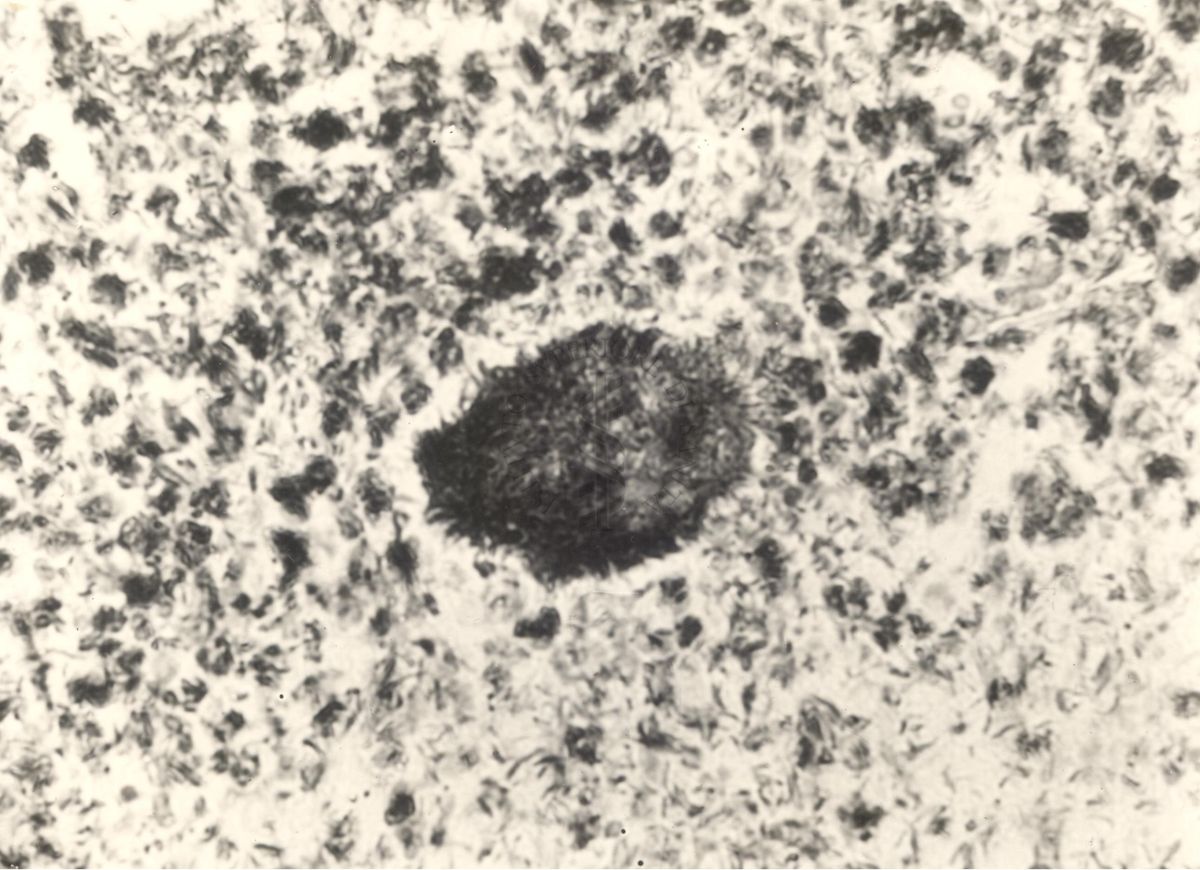 Immagine al microscopio di preparato di topino inoculato con Cow 70