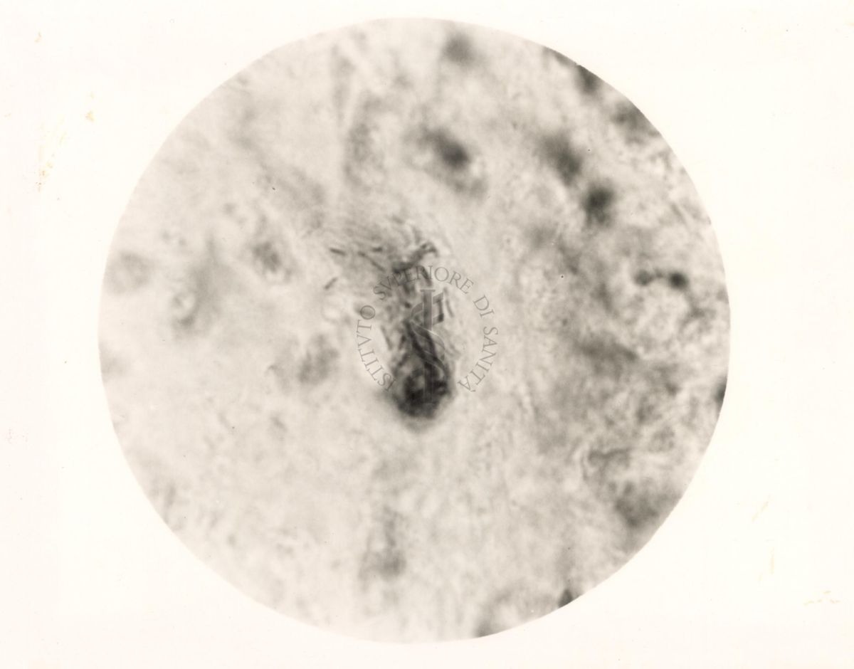 Immagine al microscopio di preparato di topino inoculato con Cow 70