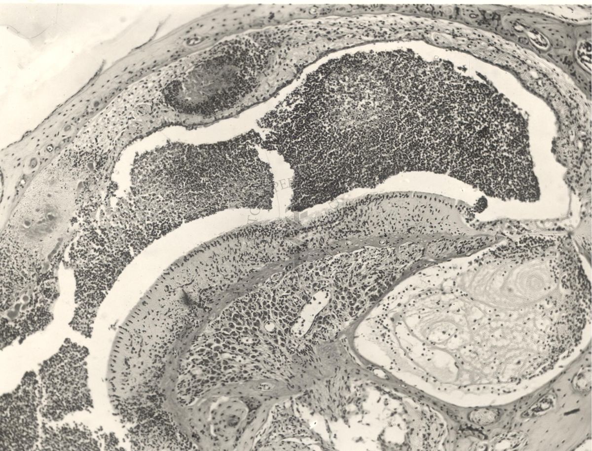 Immagine al microscopio di preparato di topino inoculato con Cow 70