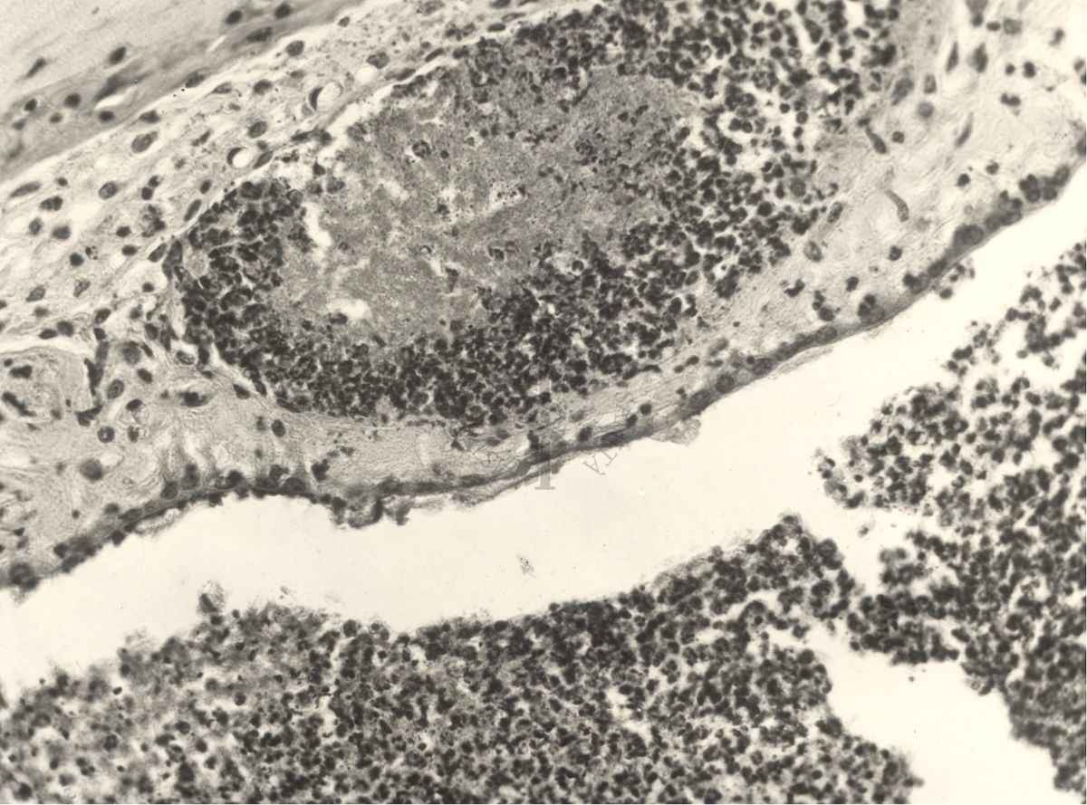 Immagine al microscopio di preparato di topino inoculato con Cow 70