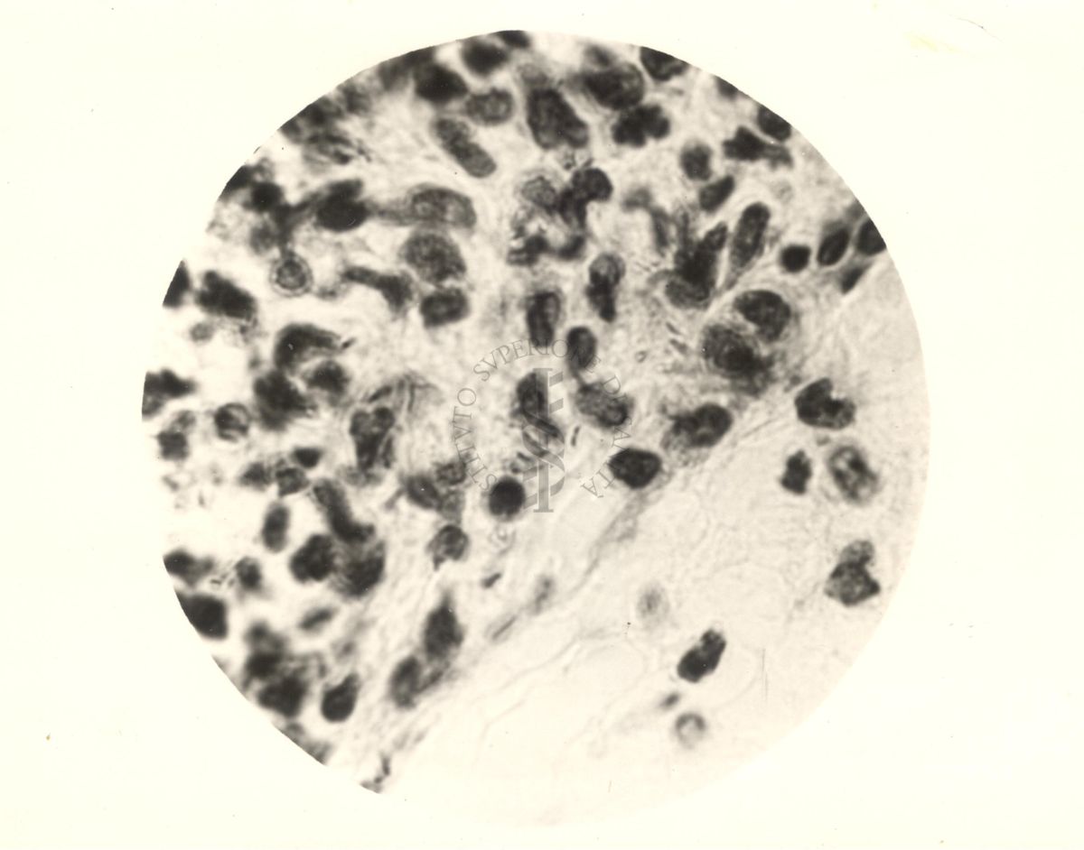 Immagine al microscopio di preparato di topino inoculato con Cow 70