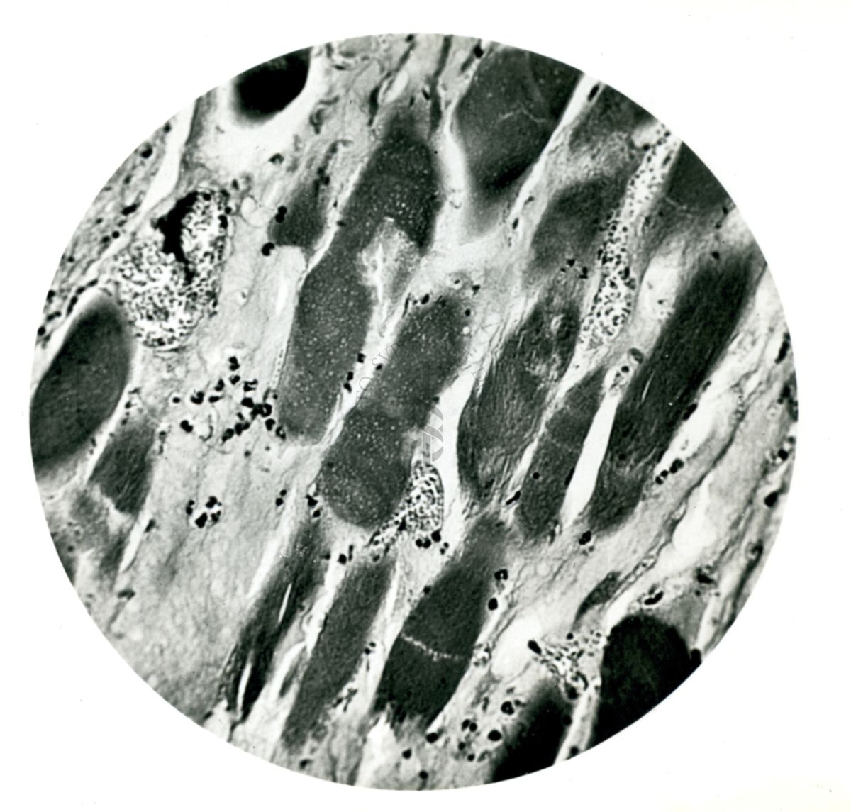 Come la precedente figura, mostra la distruzione completa degli streptococchi in un topo trattato 3 volte con iniezioni di Prontosil solubile. L'edema è già completamente senza cocchi