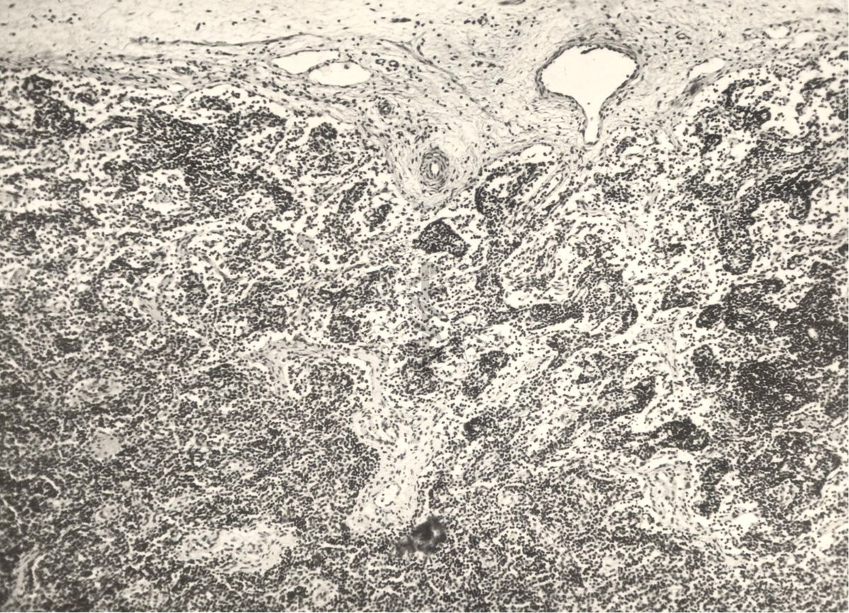 Immagine al microscopio di preparato di vitella con Cow 70