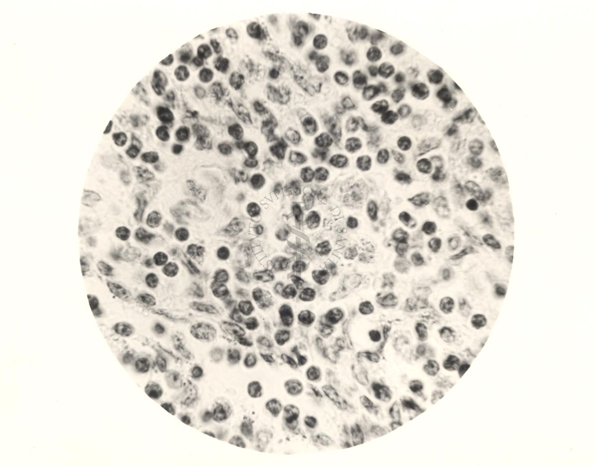 Immagine al microscopio di linfoghiandola di vitello inoculata con Cow