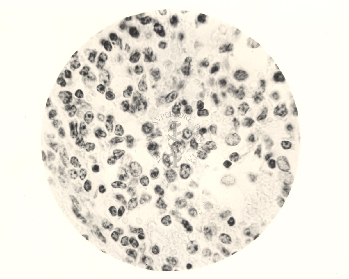 Immagine al microscopio di linfoghiandola di vitello inoculata con Cow