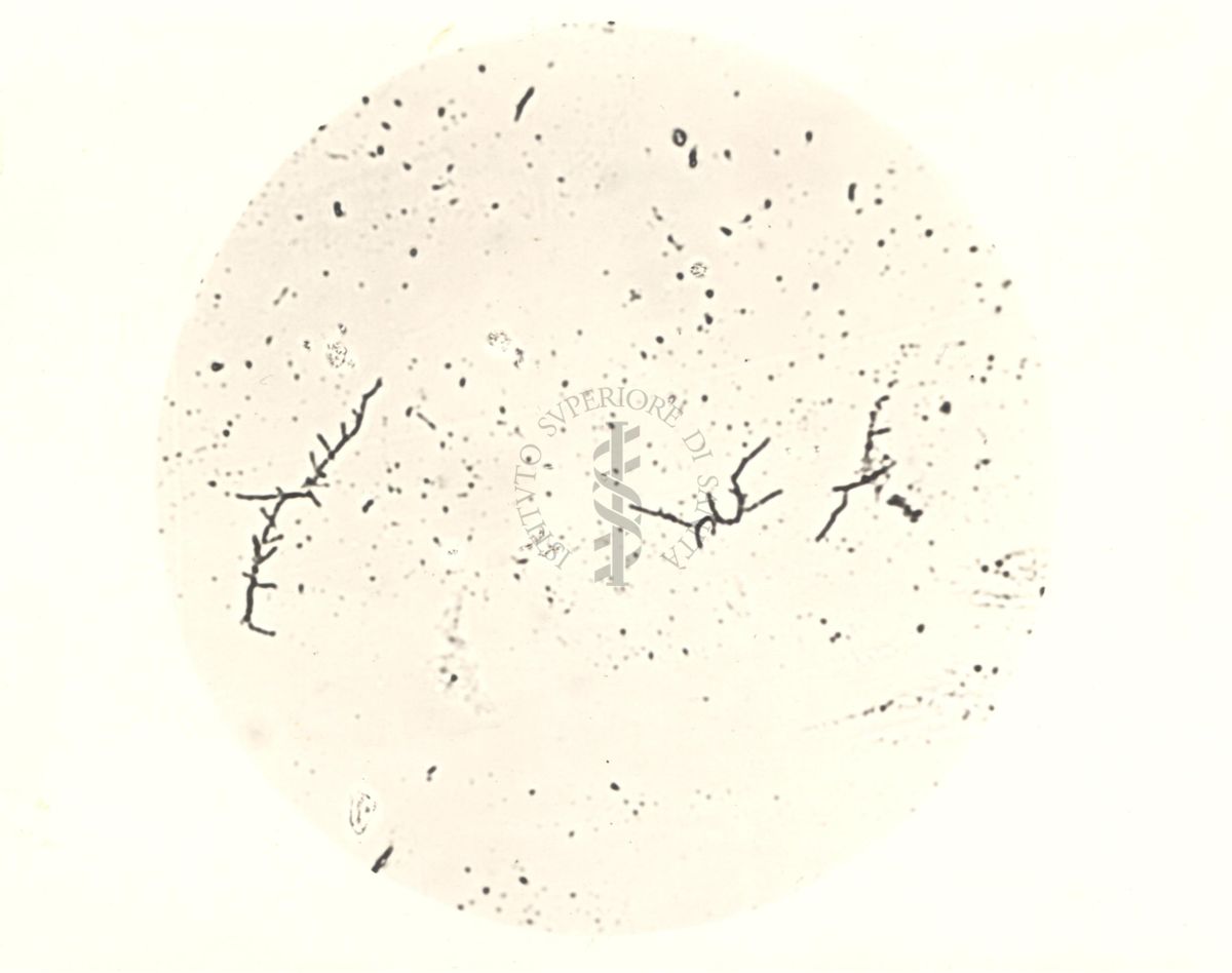 Mycobacterium Cow 70 - coltura su vetrino di 10 ore