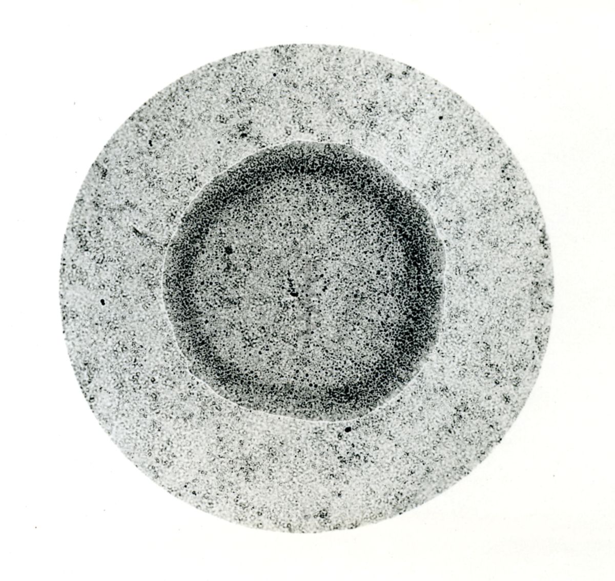 Immagine al microscopio che mostra una Pluricoltura di streptococco emolitico