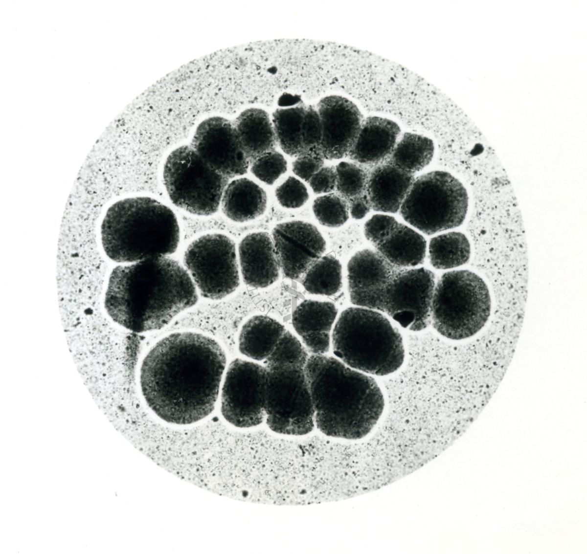 Immagine al microscopio che mostra una Pluricoltura di streptococco emolitico