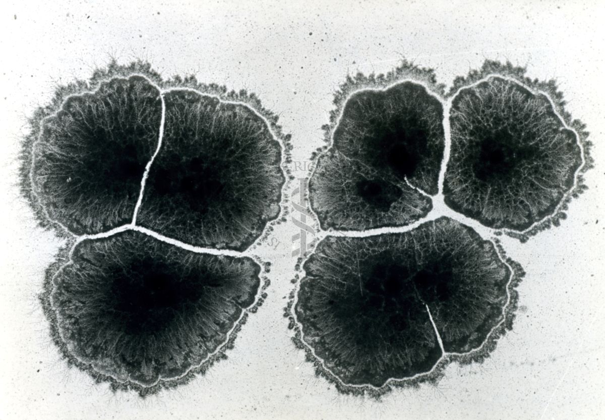 Mycobacterium tuberculosis avium - Colonie influenzatesi a vicenda