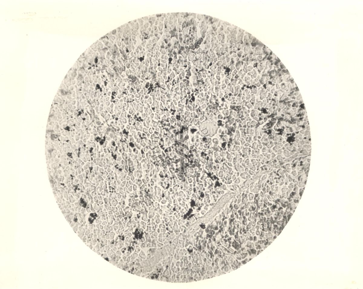 Milza di topino inoculata con Tripanblau