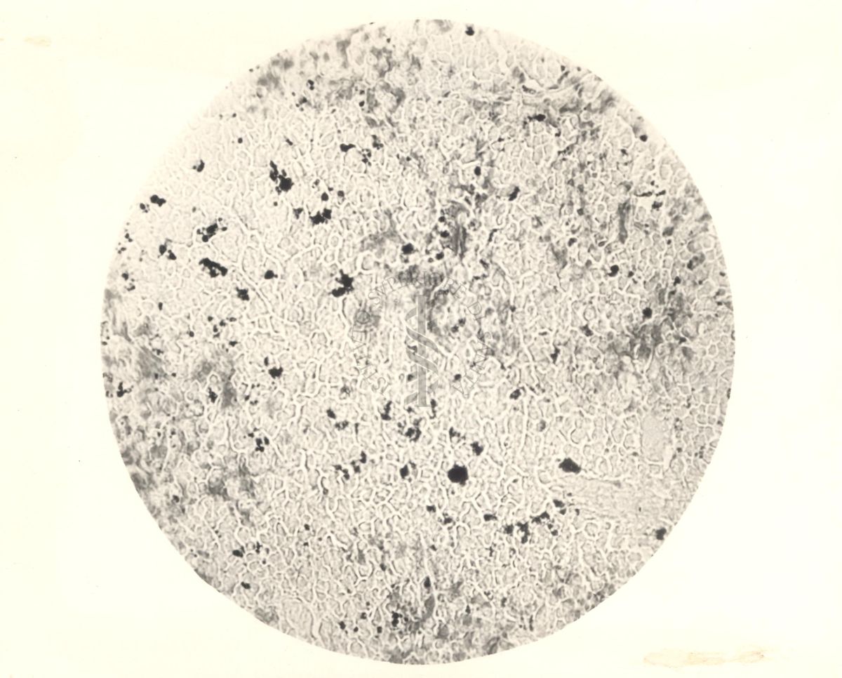 Milza di topino inoculata con Tripanblau