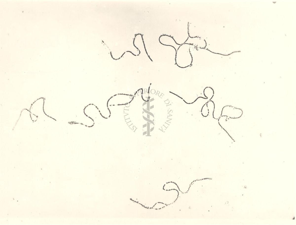 Immagine al microscopio del Carbonchio