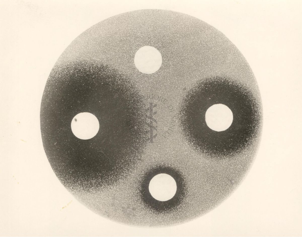 Azione dell'idrazide sul micobatterio in vitro