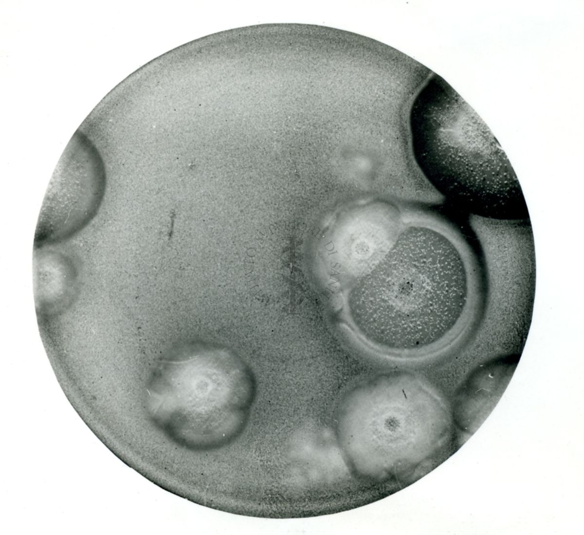 Immagine al microscopio di Placca fagica del fago pellegrino