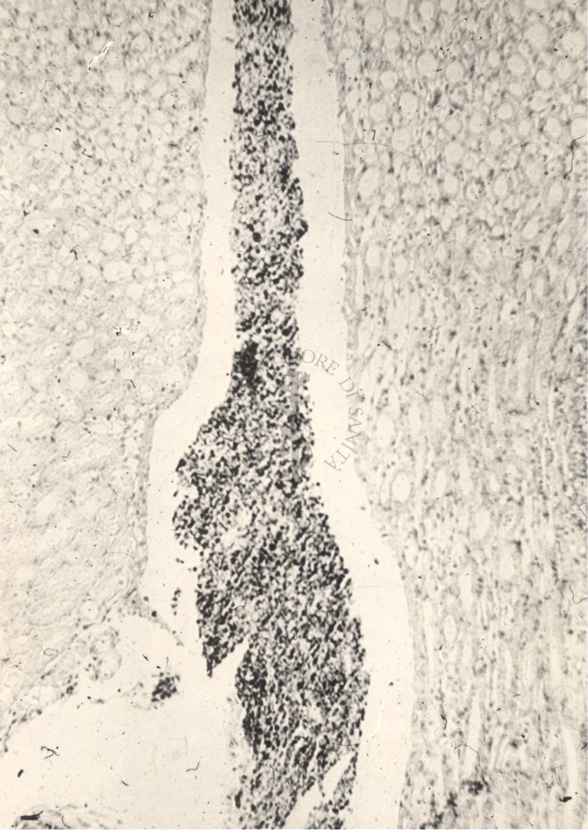 Sezione istologica di rene di topino inoculato con Mycobacterium minetti. Il bacinetto contiene numerose cellule flogistiche e micobatteri