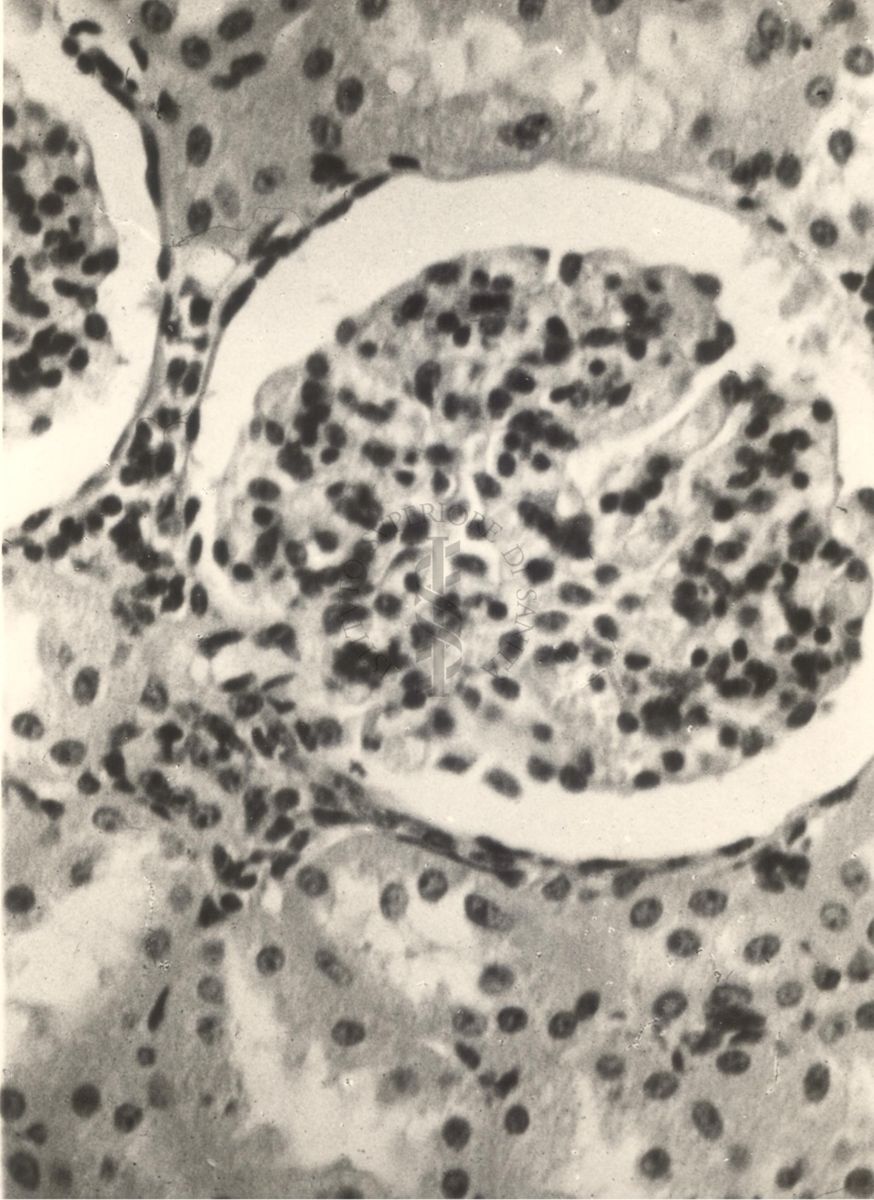 Sezione istologica di rene di vitello inoculato con Mycobacterium minetti. Glomerulo ingrossato e con piccole emorragie