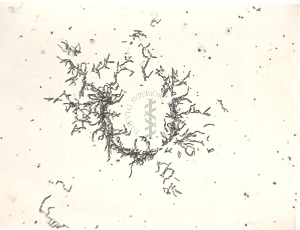 Mycobacterium sp. Ceppo Battaglini - micro colonie