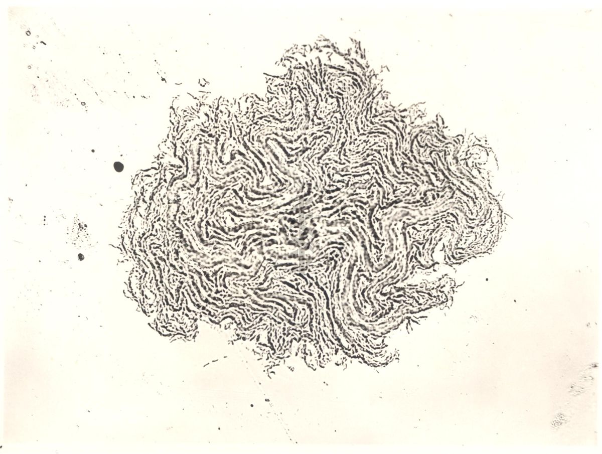 Mycobacterium sp. Ceppo Battaglini - micro colonie