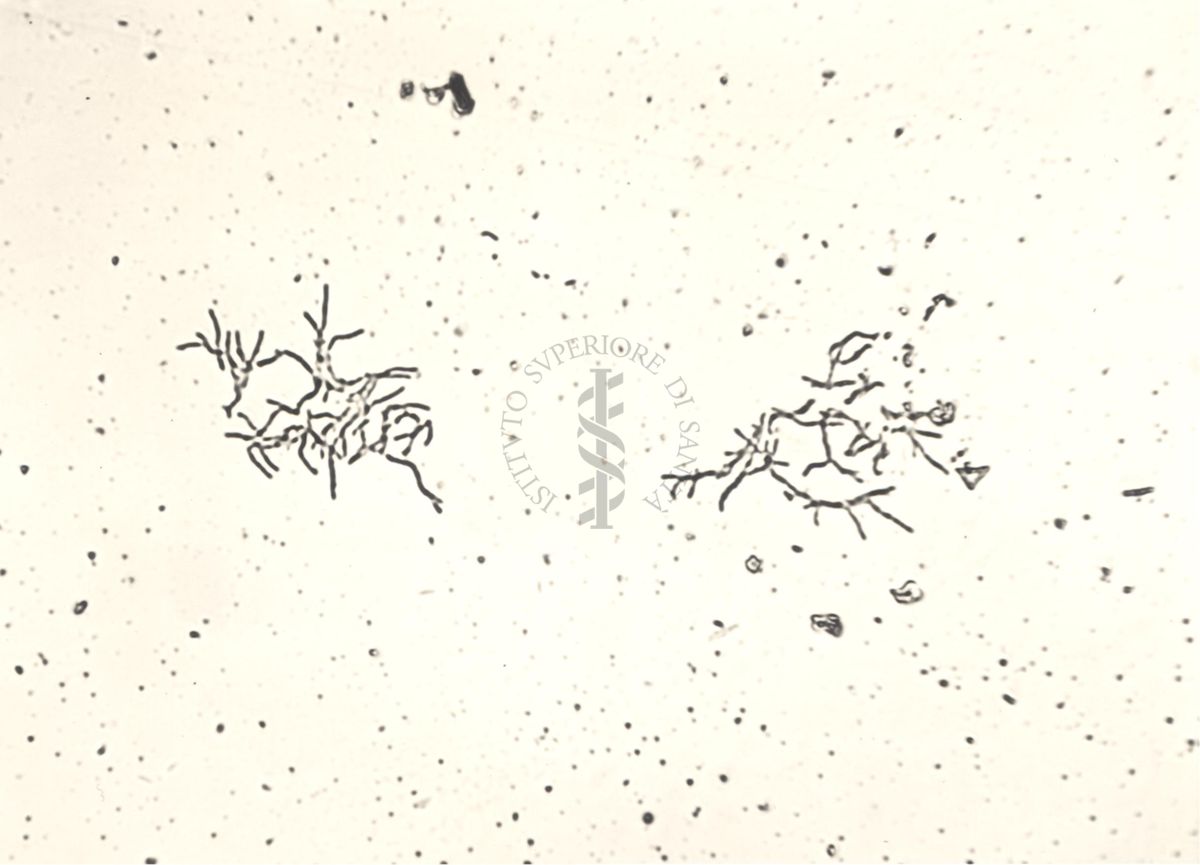 Mycobacterium sp. Ceppo Battaglini - micro colonie