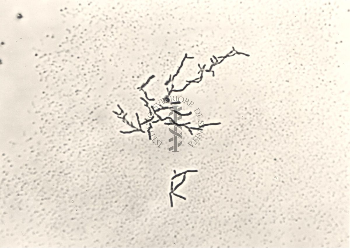 Mycobacterium sp. Ceppo Battaglini - micro colonie