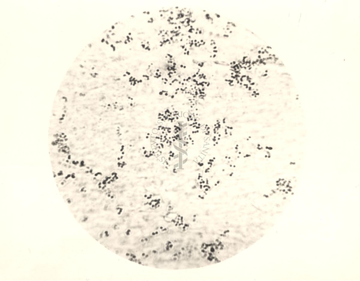 Immagine al microscopio di coltura su piastra di Micrococcus mycetoides Castellani 1942