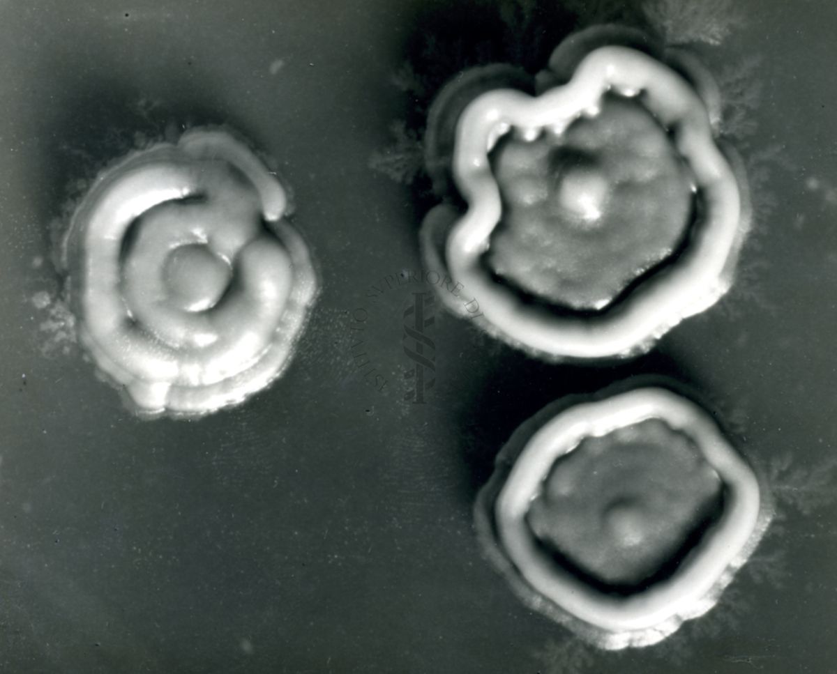 Colonie di Proactinomices - ruber