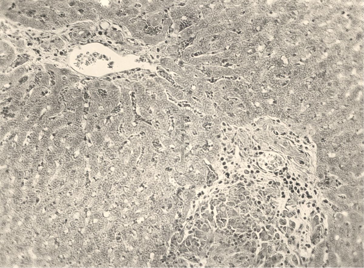 Organo di animale inoculato con Battaglini