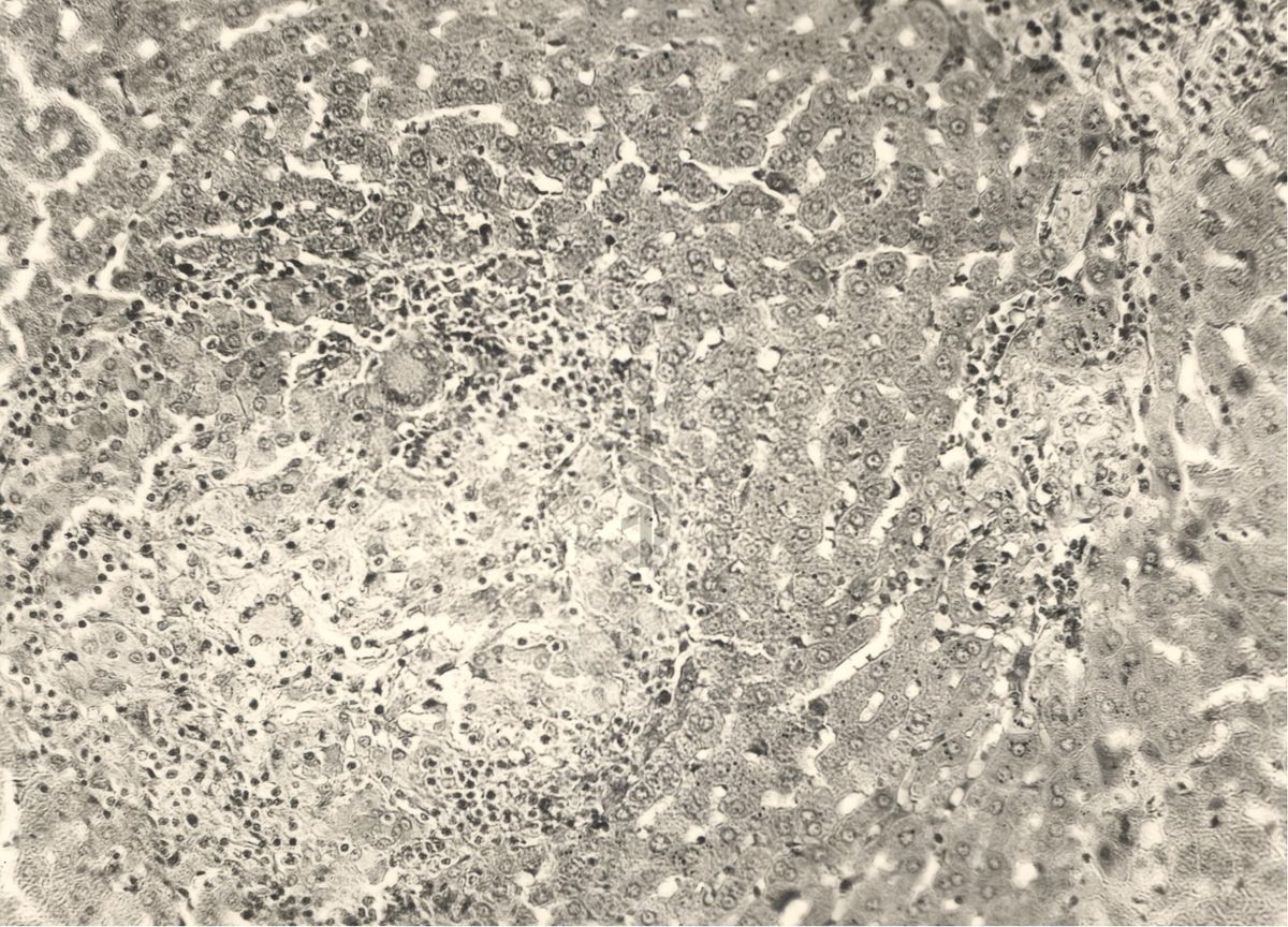 Organo di animale inoculato con Battaglini