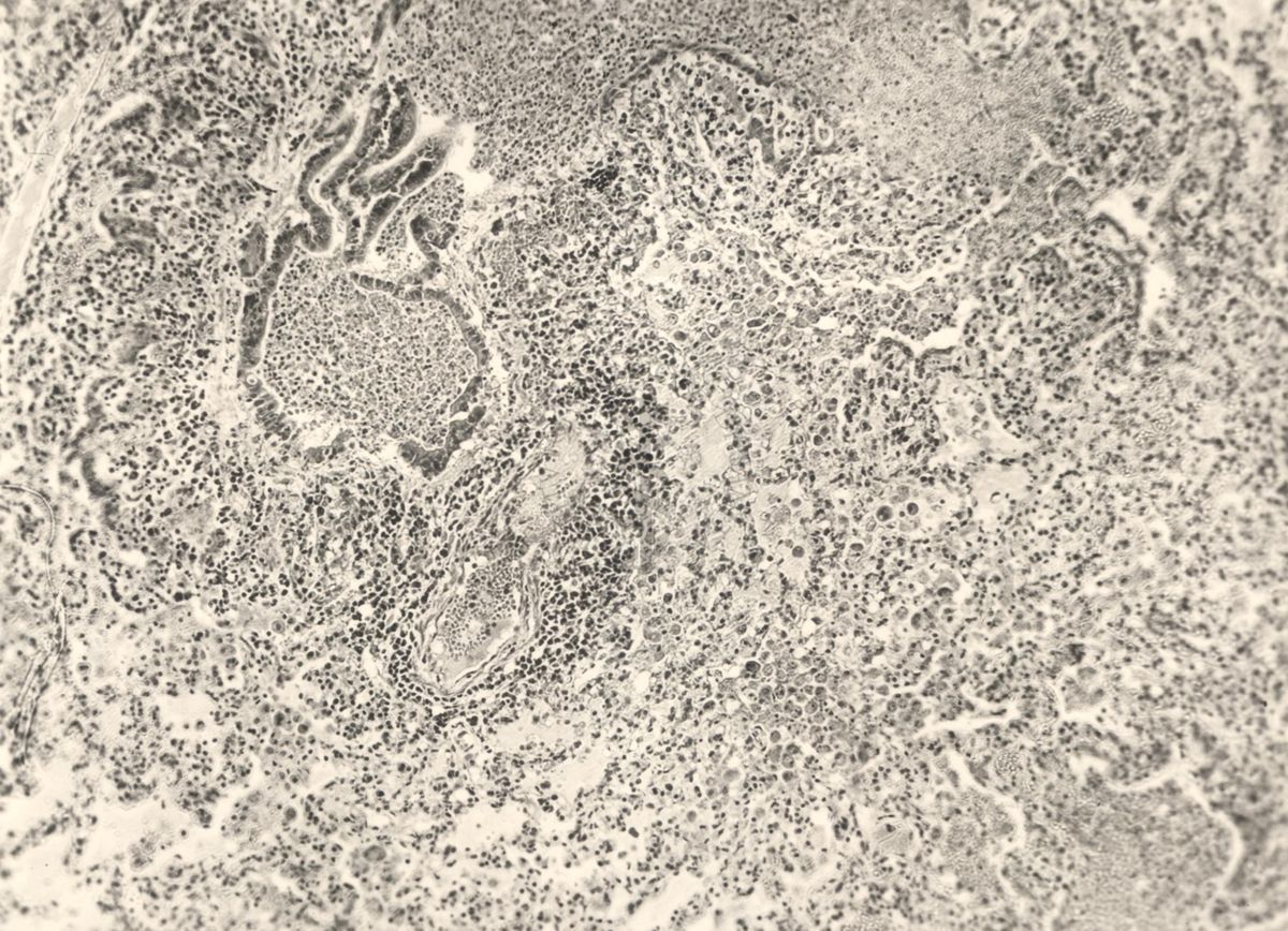 Organo di animale inoculato con Battaglini