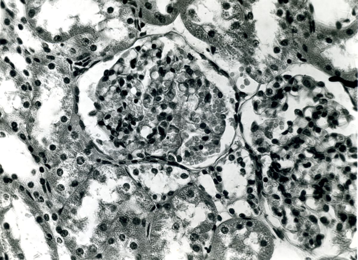 Organi di animali inoculati con Battaglini