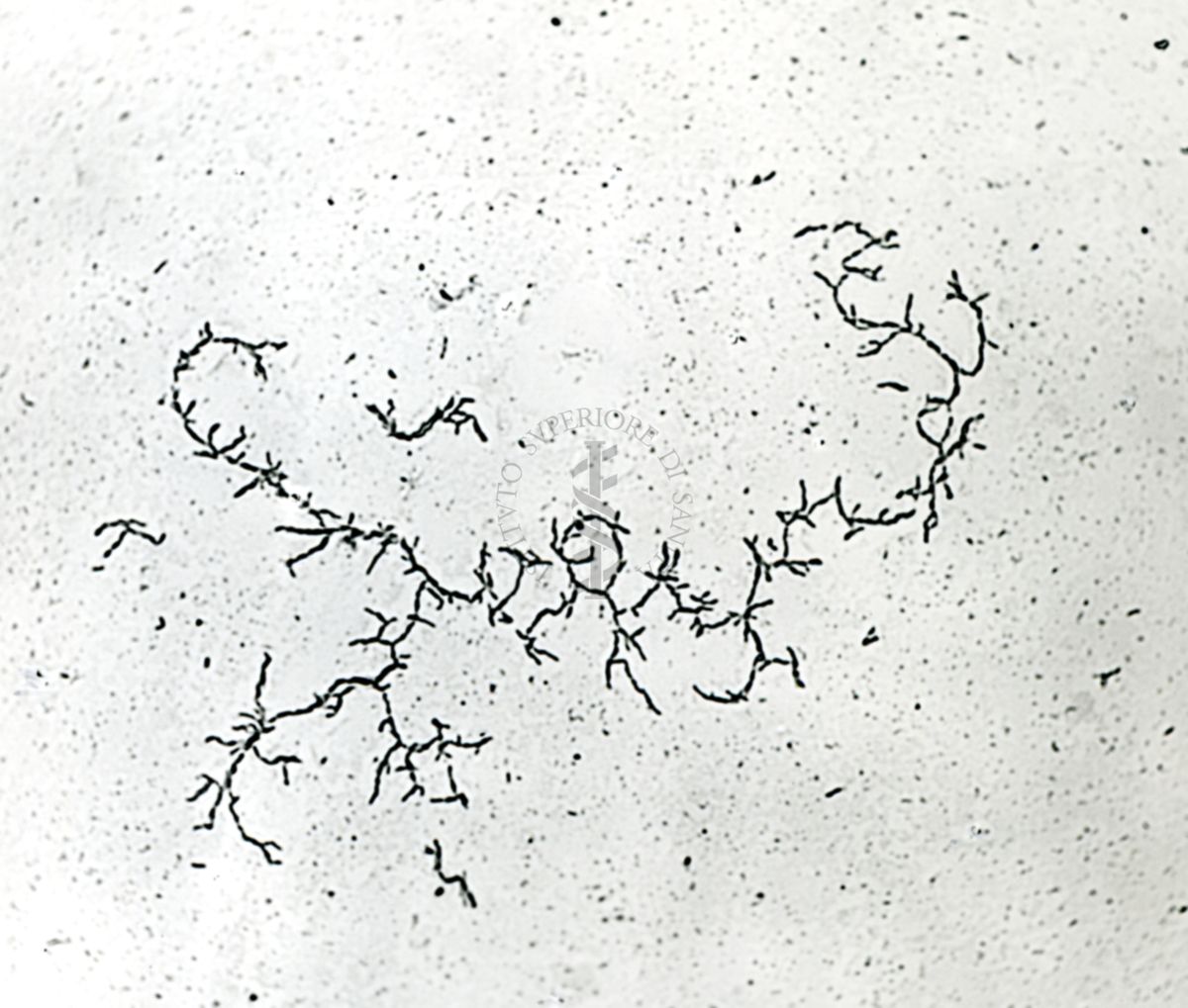 Mycobacterium tuberculosis - var. avium ceppo Sheard