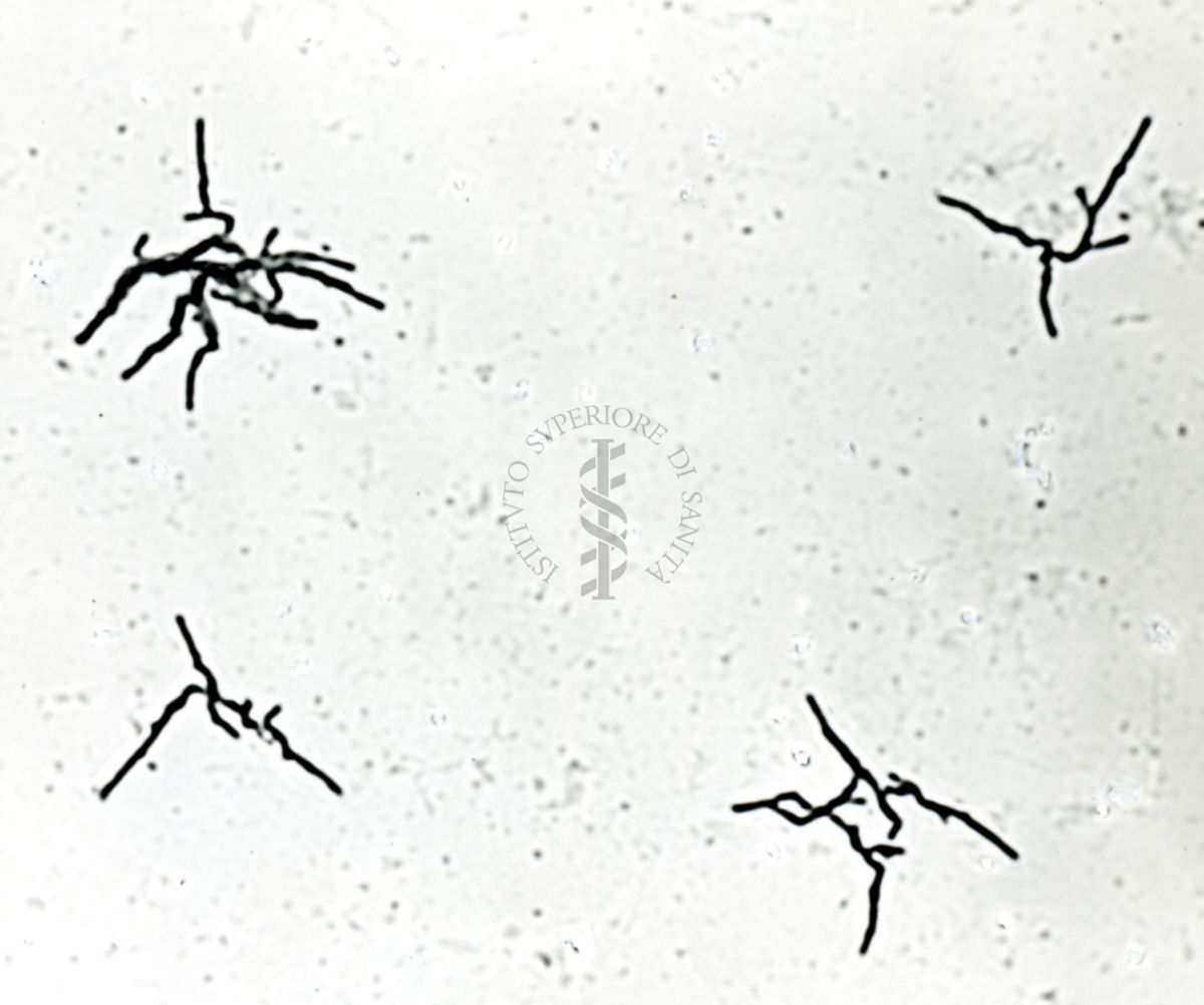 Mycobacterium tuberculosis - ceppo Vallé