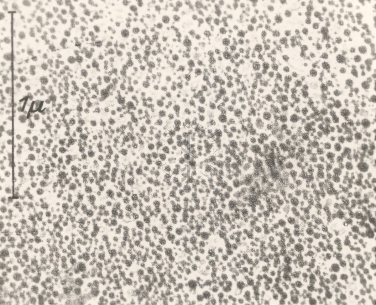 Batteriofagi (microscopio elettronico)