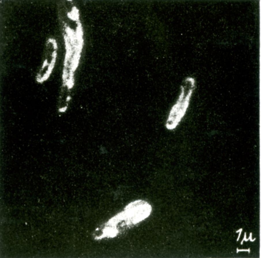 Virus del colera (ingrandimenti successivi) microscopio elettronico