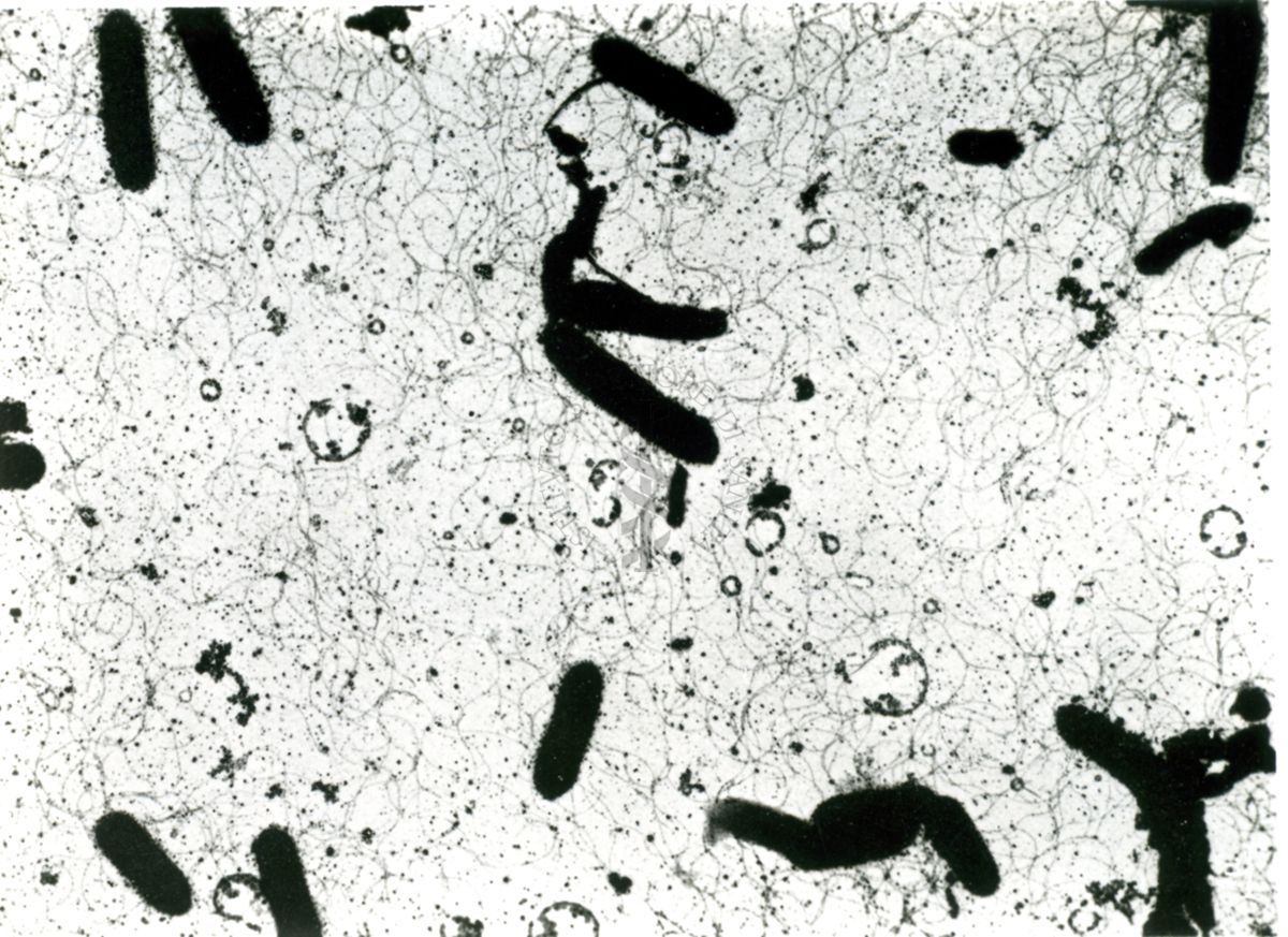 Ingrandimenti successivi di bacilli ciliati (microscopio elettronico)