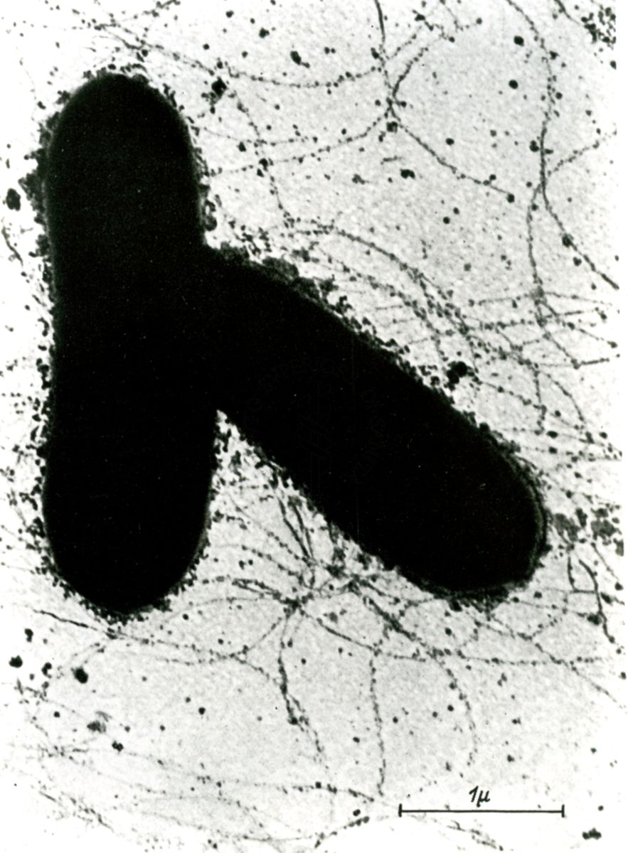 Ingrandimenti successivi di bacilli ciliati (microscopio elettronico)
