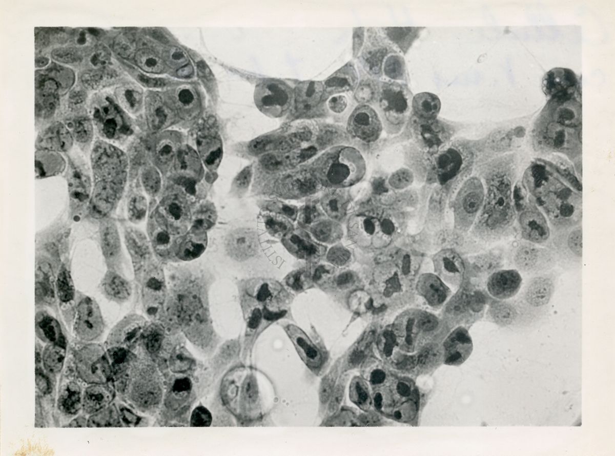 Cellule Hela con virus A.P.C. tipo II°