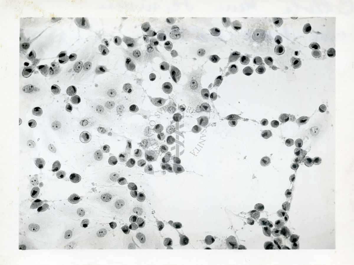 Cellule del rene di scimmia con virus ECHO