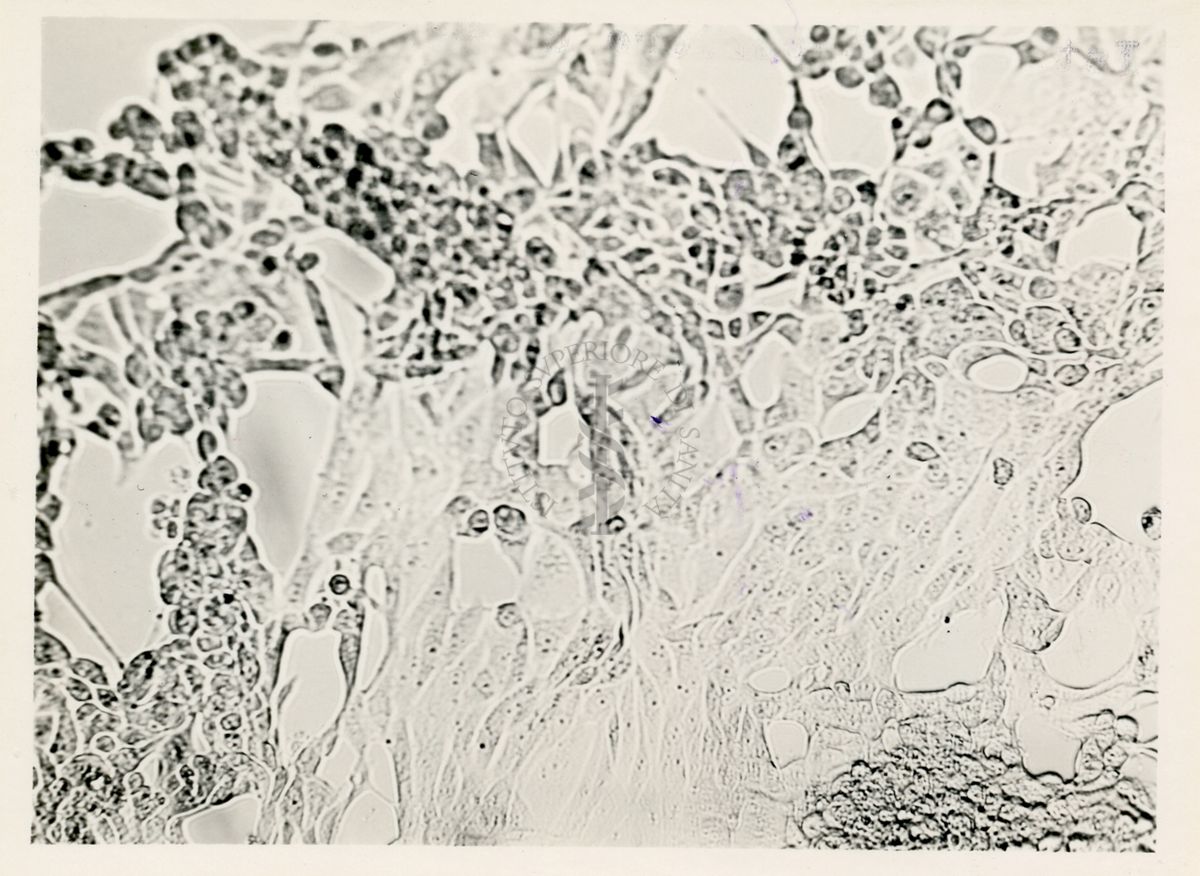 Cellule del rene di una scimmia infettate con virus Tardani a fresco